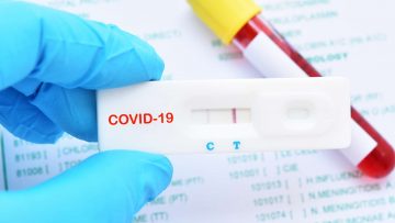 771ad4d351_50162030_test-coronavirus-4.jpg
